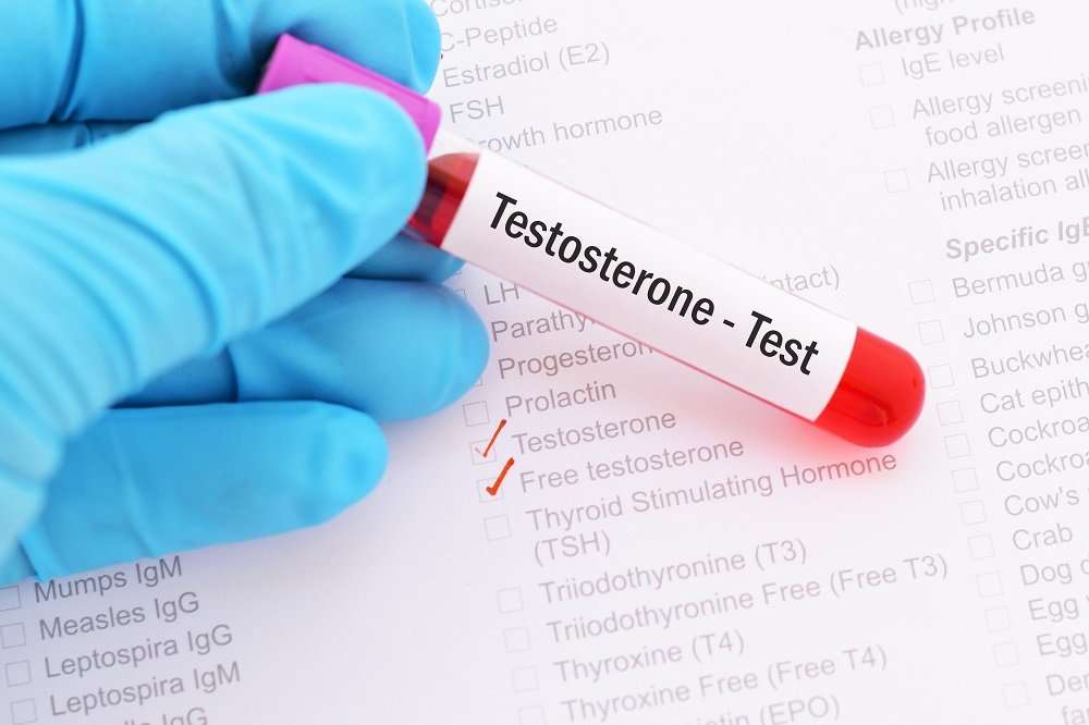 Testosterone Deficiencies Common in Men With Hepatitis C ...