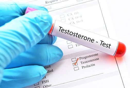 Testosterone Hormone Test Stock Photo