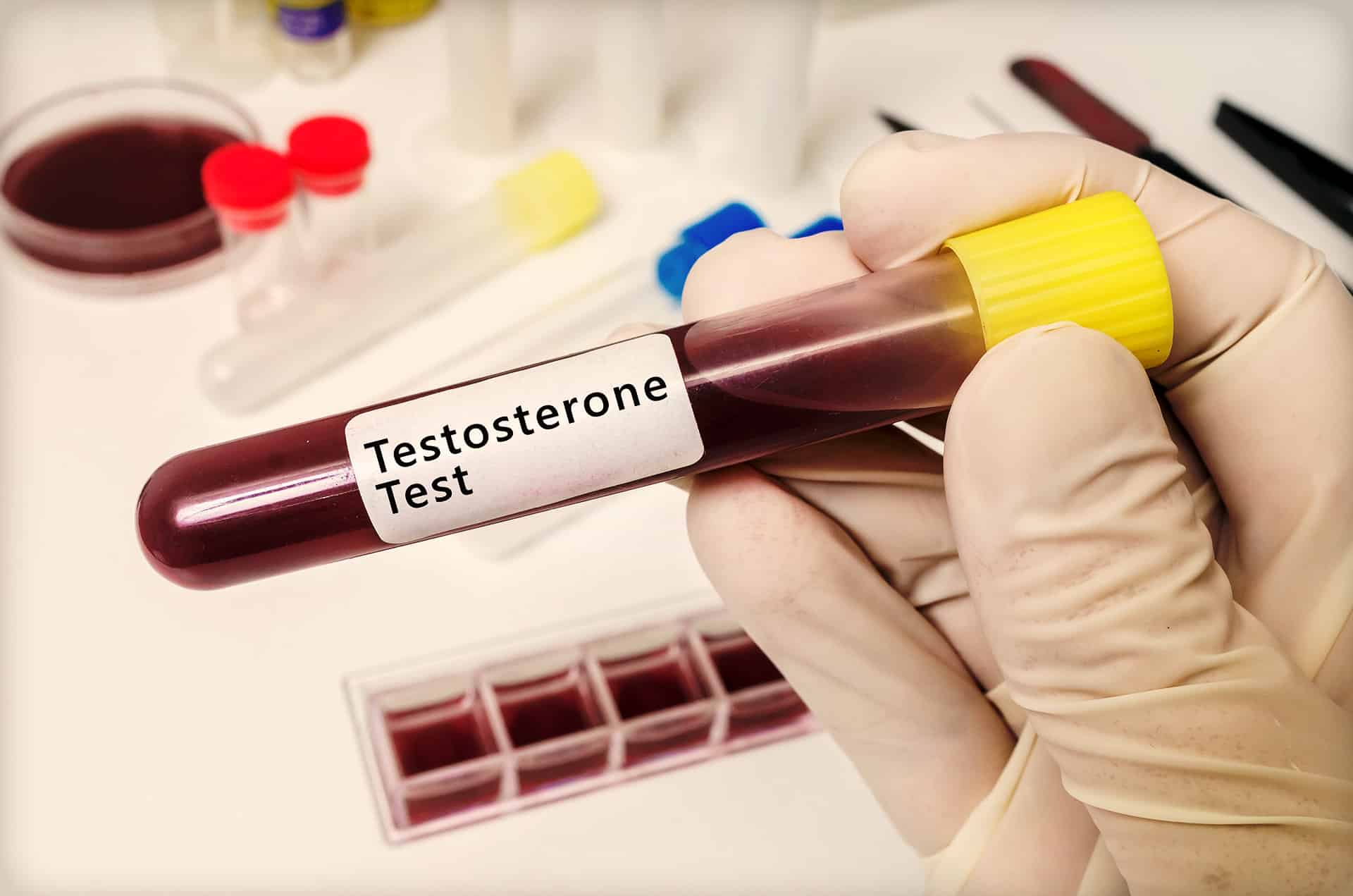 Testosterone Test Kit Home: Your T Under Your Control