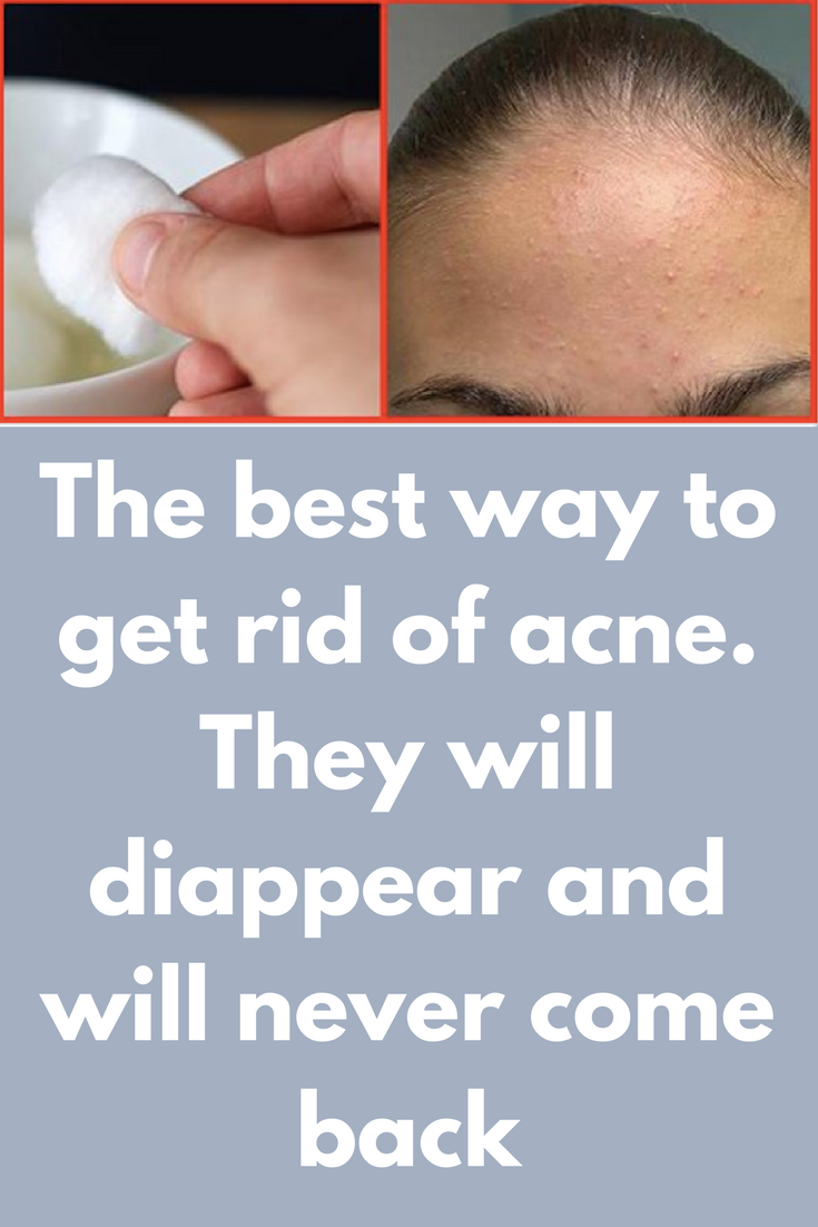 The best way to get rid of acne. They will disappear and ...
