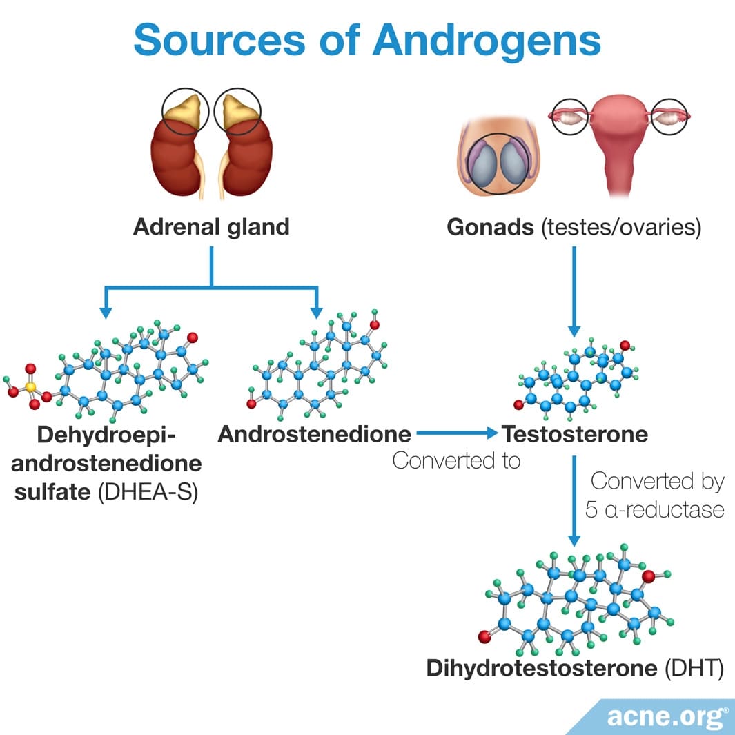 The Role of Hormones in Acne
