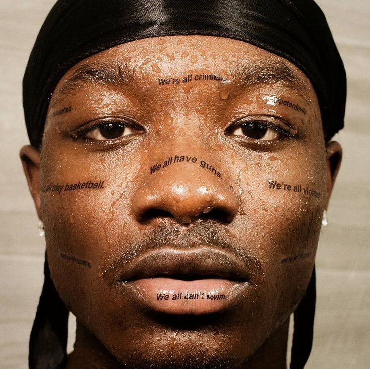 This Photographer Takes Beautiful Portraits Of People With Acne ...
