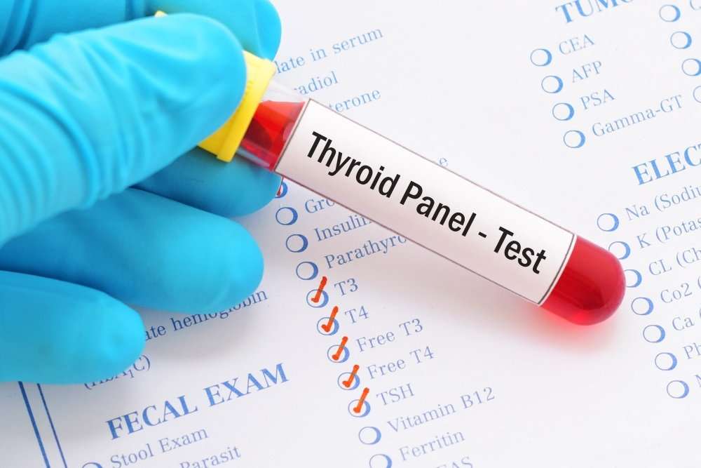 Thyroid Hormone Levels, Body Composition, Insulin ...