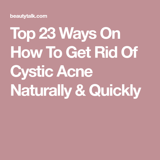 Top 23 Ways On How To Get Rid Of Cystic Acne Naturally &  Quickly ...