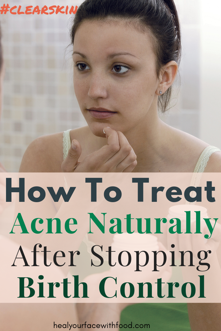 Treat acne after stopping birth control