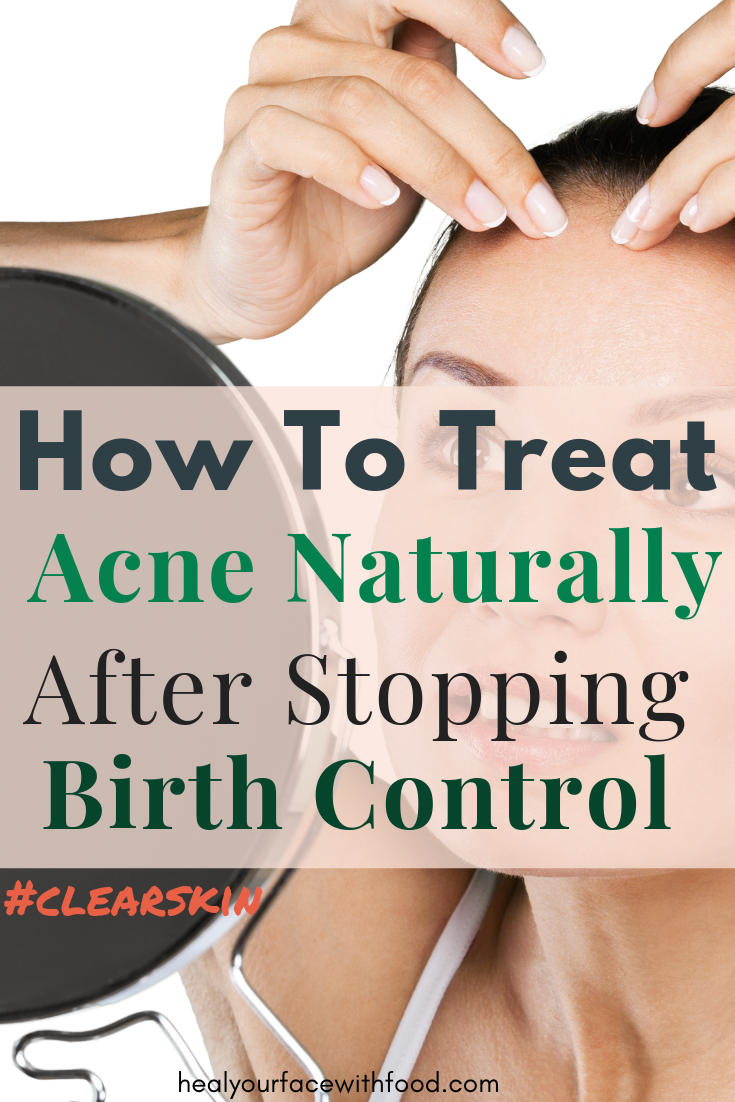 Treat acne after stopping birth control