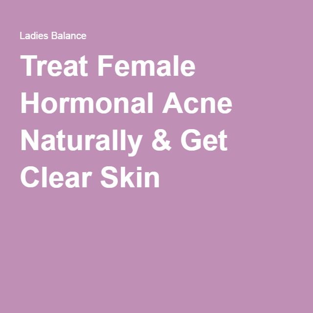 Treat Female Hormonal Acne Naturally &  Get Clear Skin (With images ...