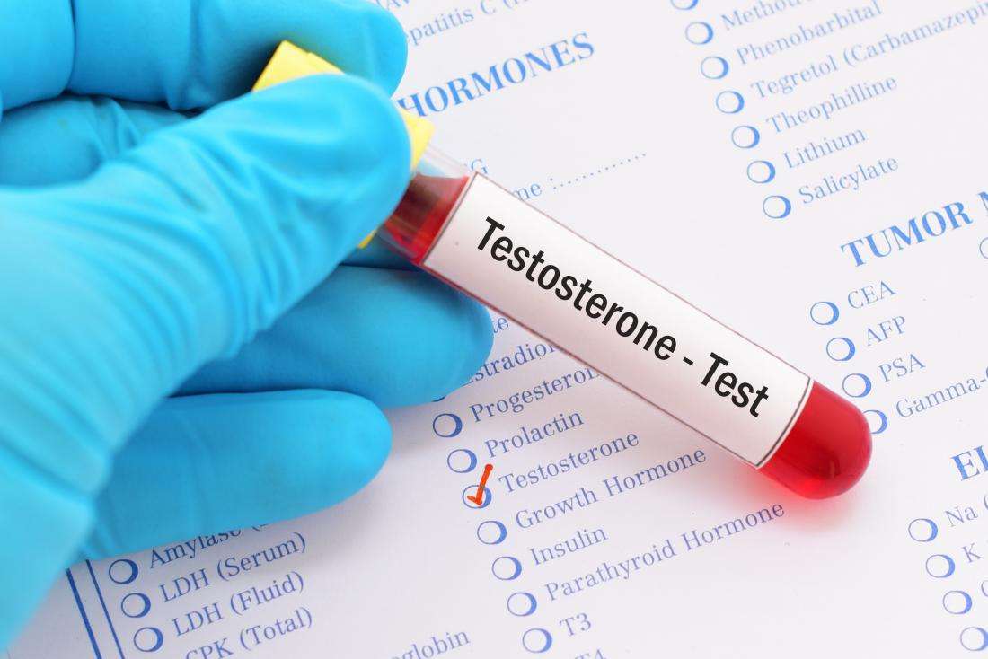 What are normal testosterone levels? Ages, males, females ...