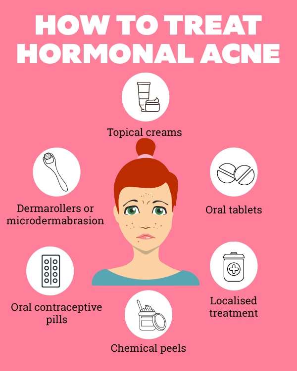 What is Hormonal Acne and How to Deal With It