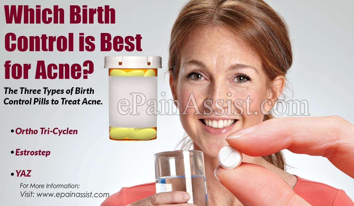 Which Birth Control is Best for Acne?
