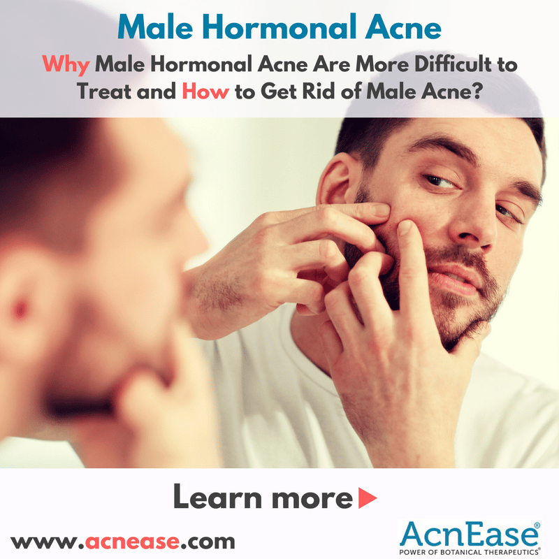 Why Male Hormonal Acne Are More Difficult to Treat and How to Get Rid ...